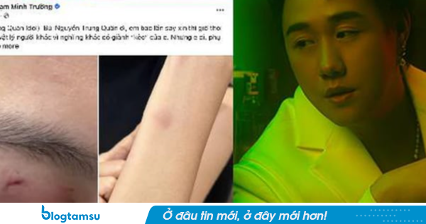 Nóng: Công an vào cuộc vụ ca sĩ Trung Quân Idol bị tố hành hung phụ nữ ở TPHCM