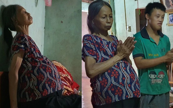 Người mẹ khổ đau đến chết xin miếng cơm cho đứa con nhiễm chất độc da cam
