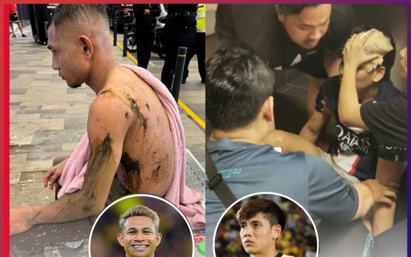 Chỉ trong 2 ngày, 2 tuyển thủ Malaysia bị tấn công: Một người bị tạt axit, người kia bị cướp đánh vỡ đầu, chuyện gì đang xảy ra?