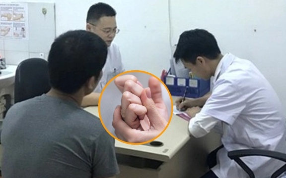 Phổi có tốt hay không, chỉ cần nhìn vào bàn tay: Người có phổi kém thường có 5 bất thường ở tay, hãy xem bạn có không