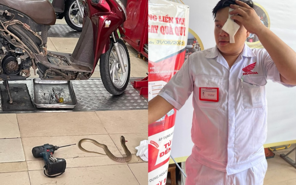 Rắn chui ra từ xe máy, phun nọc độc vào mắt kỹ thuật viên ở TP.HCM