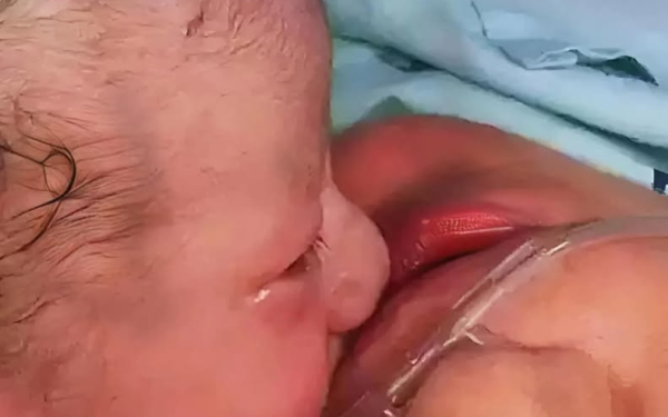 Sản phụ qua đời trên bàn sinh, phép màu xuất hiện vài giây khi em bé hôn tạm biệt mẹ