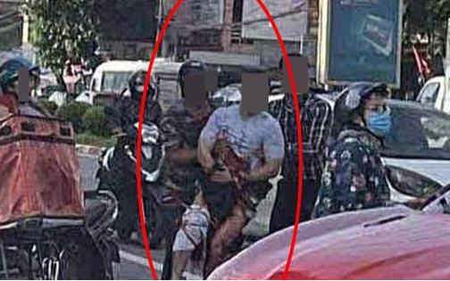 Tiktoker nổi tiếng bị ch:ém đ:ứt bàn tay trên đường: 1 tháng trước từng đăng hình ảnh bị tr:uy đ:uổi, đ:òi n:ợ