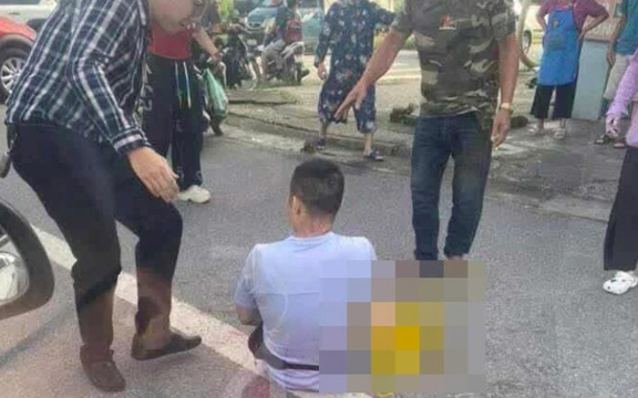 Thông tin mới nhất từ công an vụ TikToker Hà List bị chém gần đứt lìa bàn tay và lời kể của nạn nhân về khoảnh khắc hãi hùng