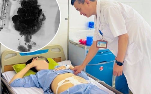 Sau 6 tháng detox bằng chanh muối tại nhà, người phụ nữ ở Bắc Ninh bị hoại tử đại tràng phải mổ cấp cứu