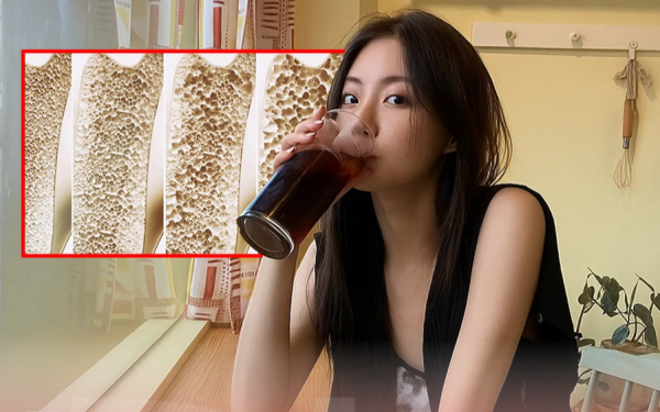 3 loại đồ uống "hút rỗng xương", người Việt uống mỗi ngày