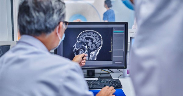 Cảnh báo: Nguy cơ đột quỵ tăng 86% ở những người có đặc điểm này ở miệng Cảnh báo: Nguy cơ đột quỵ tăng 86% ở những người có đặc điểm này ở miệng