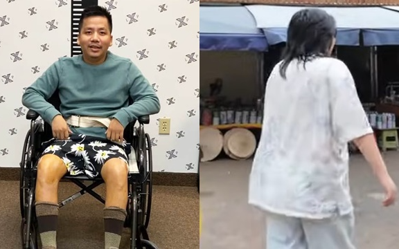 Sốc bước đi tập tễnh, di chuyển không vững của Khoa Pug sau 2 lần chi tiền tỷ kéo chân Sốc bước đi tập tễnh, di chuyển không vững của Khoa Pug sau 2 lần chi tiền tỷ kéo chân
