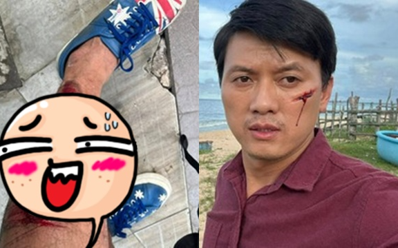 Quách Ngọc Tuyên bị tai nạn Quách Ngọc Tuyên bị tai nạn