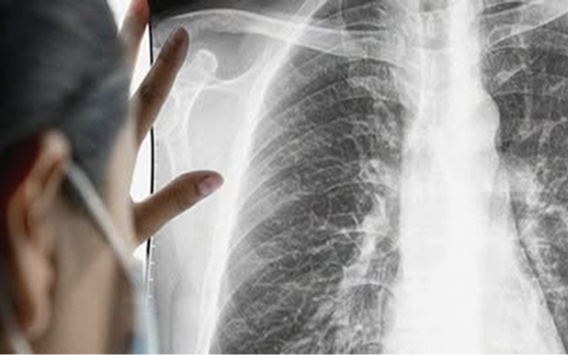 Người phụ nữ ung thư giai đoạn cuối, bật khóc khi biết thủ phạm từ chồng con Người phụ nữ ung thư giai đoạn cuối, bật khóc khi biết thủ phạm từ chồng con