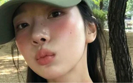 3 thứ màu đỏ "kỳ lạ" trên cơ thể thật ra là dấu hiệu UT cực ít người để ý