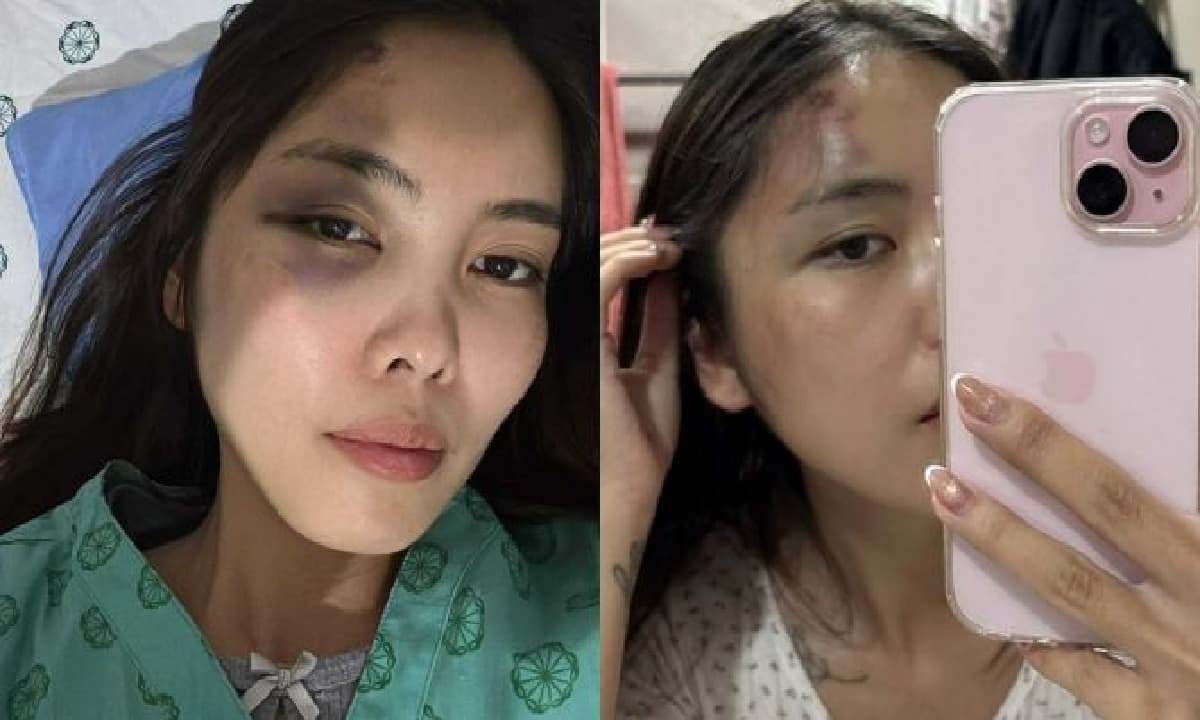 Người vợ bị chồng đánh thủng màng nhĩ, chấn động não tại Hà Nội hé lộ tình tiết phẫn nộ, vợ cũ ra mặt vạch trần bản chất người đàn ông