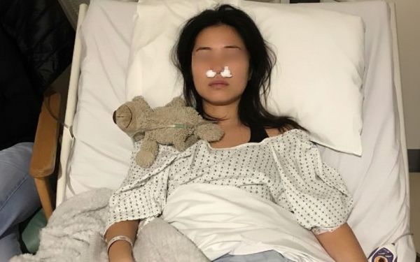 Người phụ nữ mọc cả đống nấm trong mũi vì 1 hành động "vô tri", hiếm ai chưa từng làm trong đời