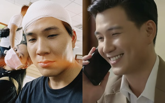 Tổng tài trăng hoa của Cách Em 1 Milimet: Đóng chung phim với diễn viên Ký Sinh Trùng, từng liệt 2 chân do bệnh quái ác