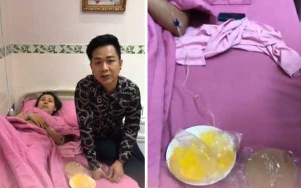 Ca sĩ vỡ túi nâng ngực trên máy bay: 