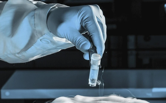 Người hiến tinh trùng mang gene ung thư làm cha của gần 200 đứa trẻ