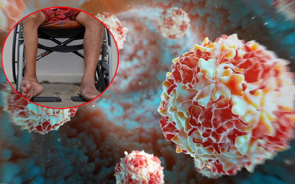 Khẩn cấp: Căn bệnh đã biến mất có ng:uy cơ quay lại, Bộ Y tế họp toàn quốc