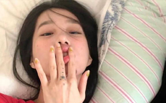 5 điều lưỡi có thể tiết lộ về sức khỏe: Từ ung thư đến nguy cơ đột quỵ cũng có thể hiện ra!