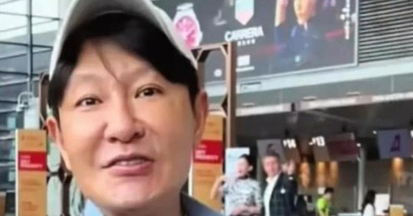 Mỹ nam biến dạng gương mặt vì thẩm mỹ