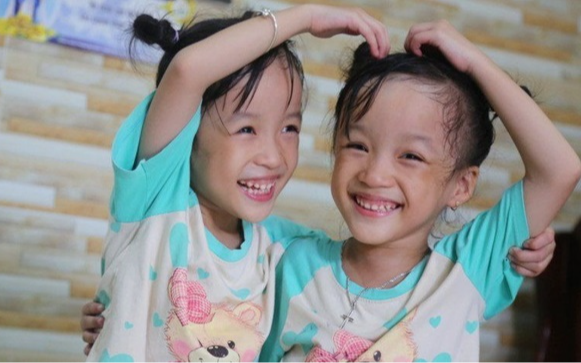 Sau cuộc đại phẫu thuật tách rời, cặp song sinh dính liền Trúc Nhi - Diệu Nhi hiện ra sao?