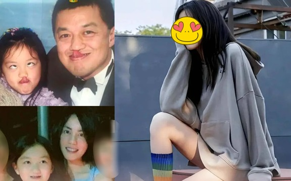 Ngoại hình con gái Vương Phi sau khi chi tiền tỷ để phẫu thuật hở hàm ếch