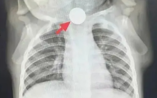 Bé trai bỏ ăn cả tuần, nguyên nhân được phát hiện khiến bà nội phải thốt lên: "Đúng là lỗi của tôi"