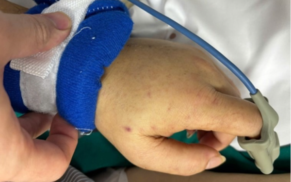 Bệnh viện Bạch Mai phát cảnh báo về 1 căn bệnh nguy hiểm, lây lan nhanh, tỷ lệ tử vong cao