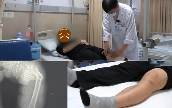 Ngoài 30 tuổi xương đã "xốp như tổ ong", ho cũng gãy xương đùi vì mê loại nước "ngòn ngọt", uống tê đầu lưỡi