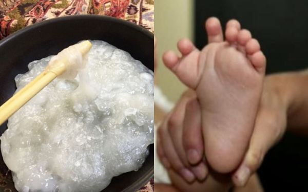 Bé 5 tháng tổn thương gan nghiêm trọng vì người lớn dùng đũa chấm vào rượu cho bé nếm thử