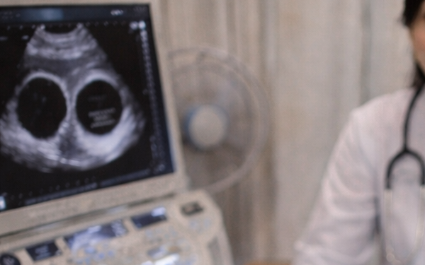 Đẻ xong thấy cơ thể có dấu hiệu lạ, cô gái 19 tuổi khiến ê-kíp bác sĩ sững người khi xem kết quả siêu âm