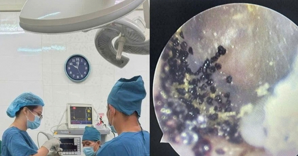 Hình ảnh từ tai em bé 7 tuổi ở Khánh Hoà khiến nhiều cha mẹ "nổi da gà": Nuôi con không thể lơ là điều này được!