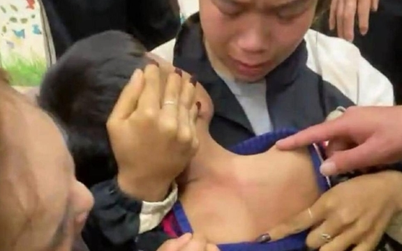 Không có dấu hiệu tội phạm vụ học sinh lớp 1 bị 