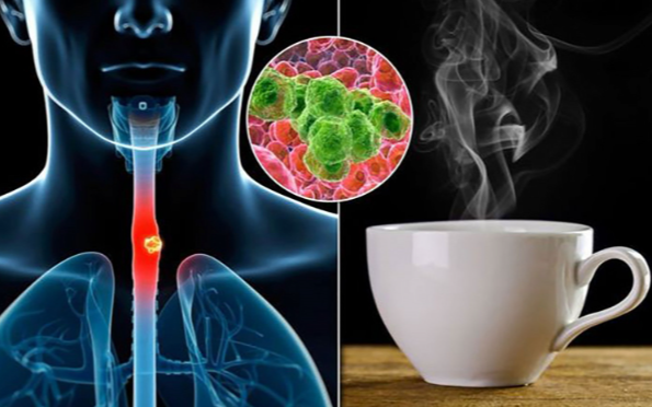 Loại nước "nuôi tế bào ung thư", uống mỗi ngày có thể tăng gấp 6 lần nguy cơ: Nhiều người Việt hay dùng