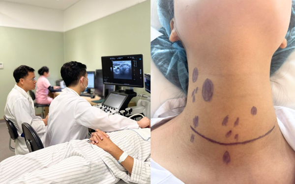 Cô gái 24 tuổi ở Hà Nội phát hiện ung thư tuyến giáp di căn hơn 20 hạch sau khi sờ thấy 1 thứ ở cổ