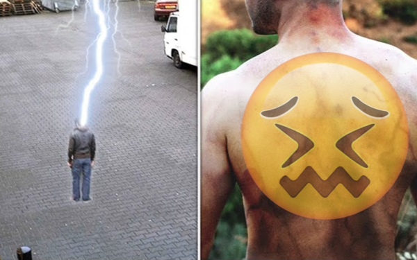 Người đàn ông sống sót sau 4 lần bị sét đánh, kể lại điều thực sự xảy ra với cơ thể mình