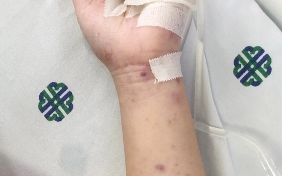 Căn bệnh diễn tiến tối cấp, đe dọa tính mạng chỉ trong 24 giờ