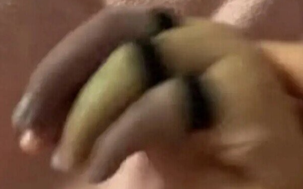 Con ngồi chơi ở phòng khách bỗng khóc rống lên, mẹ phát hoảng thấy tay con 3 màu, bác sĩ cảnh báo