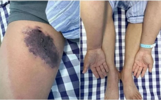 Mặc chiếc quần cũ, người đàn ông suýt "nhiễm độc toàn thân"