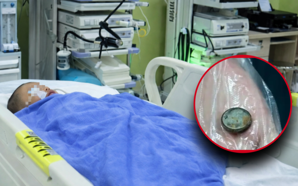 Bé trai nuốt phải pin cúc áo, mẹ cho uống ngay 1 thìa gia vị, đến bệnh viện bác sĩ khen: "Giỏi lắm"