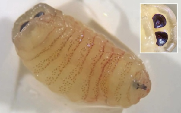 Người phụ nữ Hy Lạp hắt hơi ra hàng loạt giòi sống