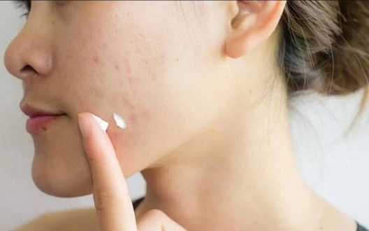 Một loại kem nghệ bị thu hồi khẩn, lý do khiến nhiều người giật mình