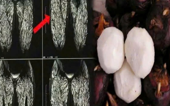 Những loại thực phẩm quen thuộc là ‘ổ chứa vi khuẩn’ khi ăn cần cực kỳ thận trọng