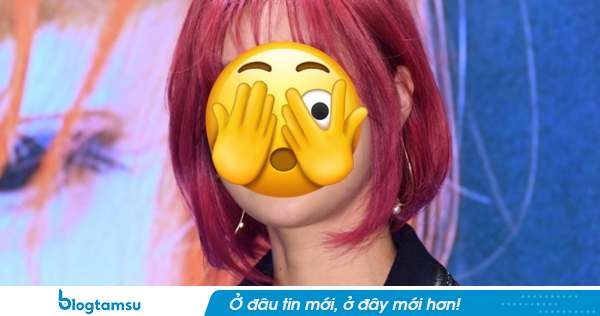 Nữ diễn viên gặp tai nạn kinh hoàng: 
