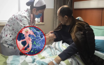 Bệnh nhân khỏi cả HIV lẫn UT nhờ gene hiếm của anh trai