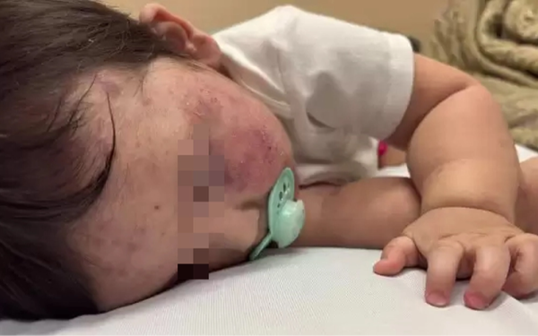 Bé trai 11 tháng tử vong sau 5 tiếng chờ bác sĩ, người mẹ đau khổ nói: "Lẽ ra con tôi có thể được cứu"