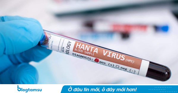 Bộ Y tế cảnh báo khẩn về vi rút Hanta sau ổ dịch chết người trên tàu du lịch