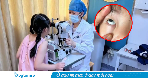 Phát hiện đốm đen trong tròng mắt con, gia đình hoang mang nhanh chóng cho bé nhập viện và cái kết không ngờ