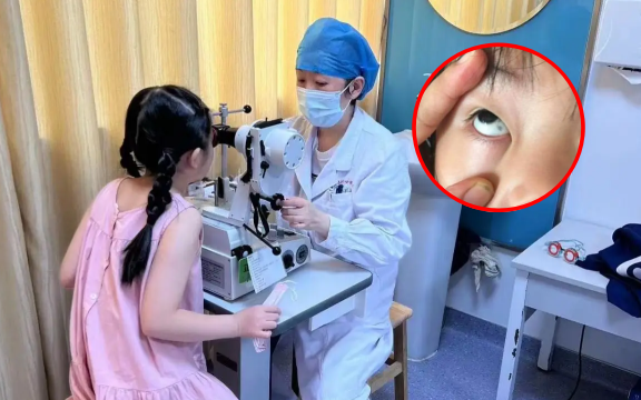 Phát hiện đốm đen trong tròng mắt con, gia đình hoang mang nhanh chóng cho bé nhập viện và cái kết không ngờ