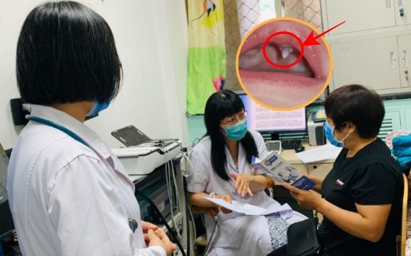 Con 3 tháng tuổi không ngừng khóc, mẹ phát hoảng khi thấy trong miệng con mọc răng nanh, đến bệnh viện bác sĩ lắc đầu