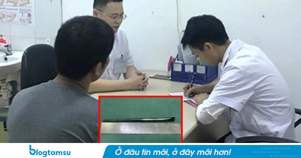 Hy hữu người đàn ông sống 8 năm với chiếc đũa kim loại mắc trong cổ họng và cái kết